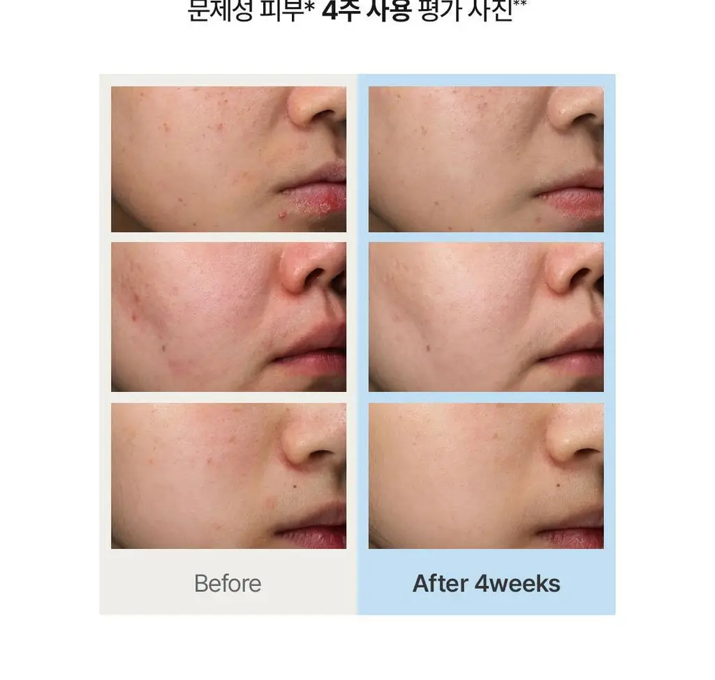 [장원영PICK] 닥터엘시아 345 릴리프 크림 50ml 상세페이지 15